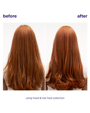 Head & Hair Heal Conditioner